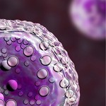 Podcast A Critical Update on Relapsed/Refractory Diffuse Large B-Cell Lymphoma and CAR T-cell Therapy