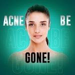 Logo of the podcast Acne Be Gone Podcast Podcast Acne Be Gone Podcast