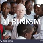 Logo of the podcast ALBINISM Podcast ALBINISM