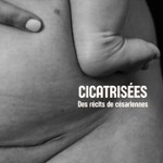 Logo of the podcast Cicatrisées Podcast Cicatrisées