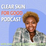 Podcast Clear Skin For Good | Tips Clearing Acne Without Cutting Out More Foods