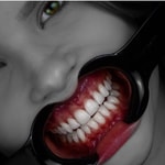 Podcast Dentcast 