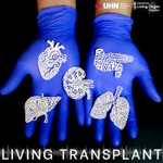 Living Transplant: Patient Stories | Organ Donation | Medical Experts Podcast Living Transplant: Patient Stories | Organ Donation | Medical Experts