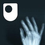 Logo of the podcast Rheumatoid arthritis - a long term condition - for iPod/iPhone Podcast Rheumatoid arthritis - a long term condition - for iPod/iPhone